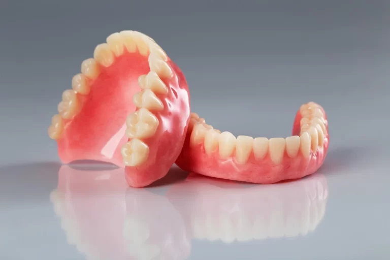 Worn teeth overdenture