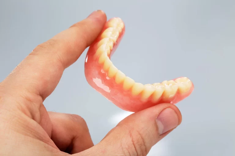 Removable Partial Denture